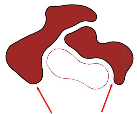 CAD導(dǎo)圖的時候頻繁出現(xiàn)斷線 CAD導(dǎo)圖的時候頻繁出現(xiàn)斷線